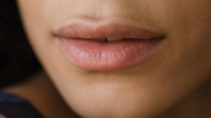 Lippenunterspritzung: Russian Lips & die wahre Ästhetik