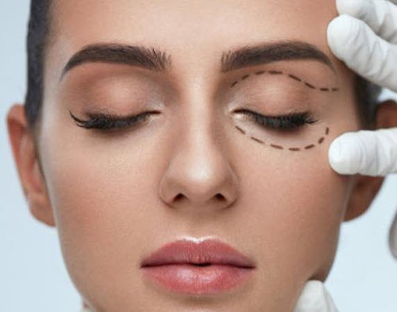 10 Ratschläge für eine Augenlidstraffung OP